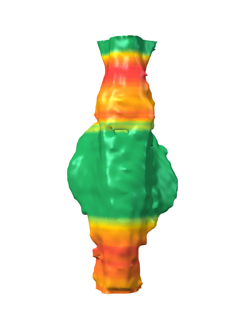 Atemweg in 3D
